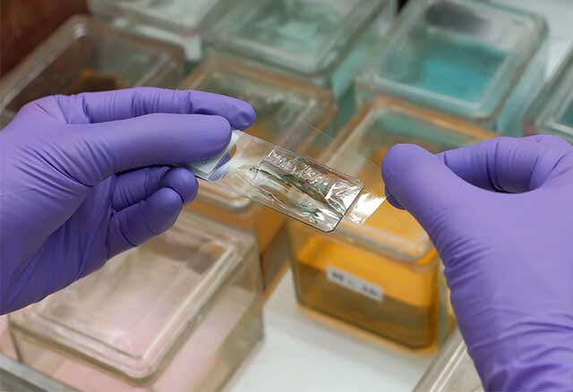 Smear Testi Nedir